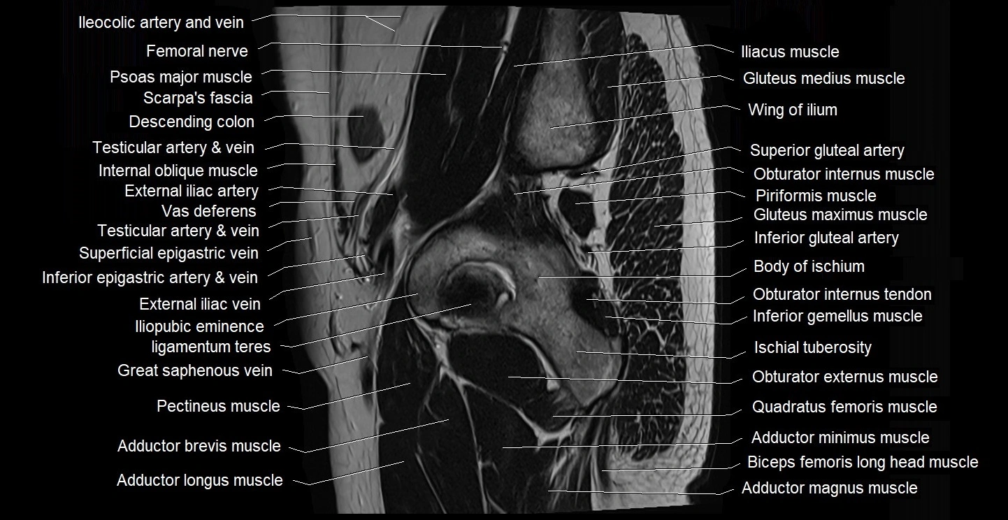 male pelvis sagittal cross sectional anatomy 3T mri image 6.webp